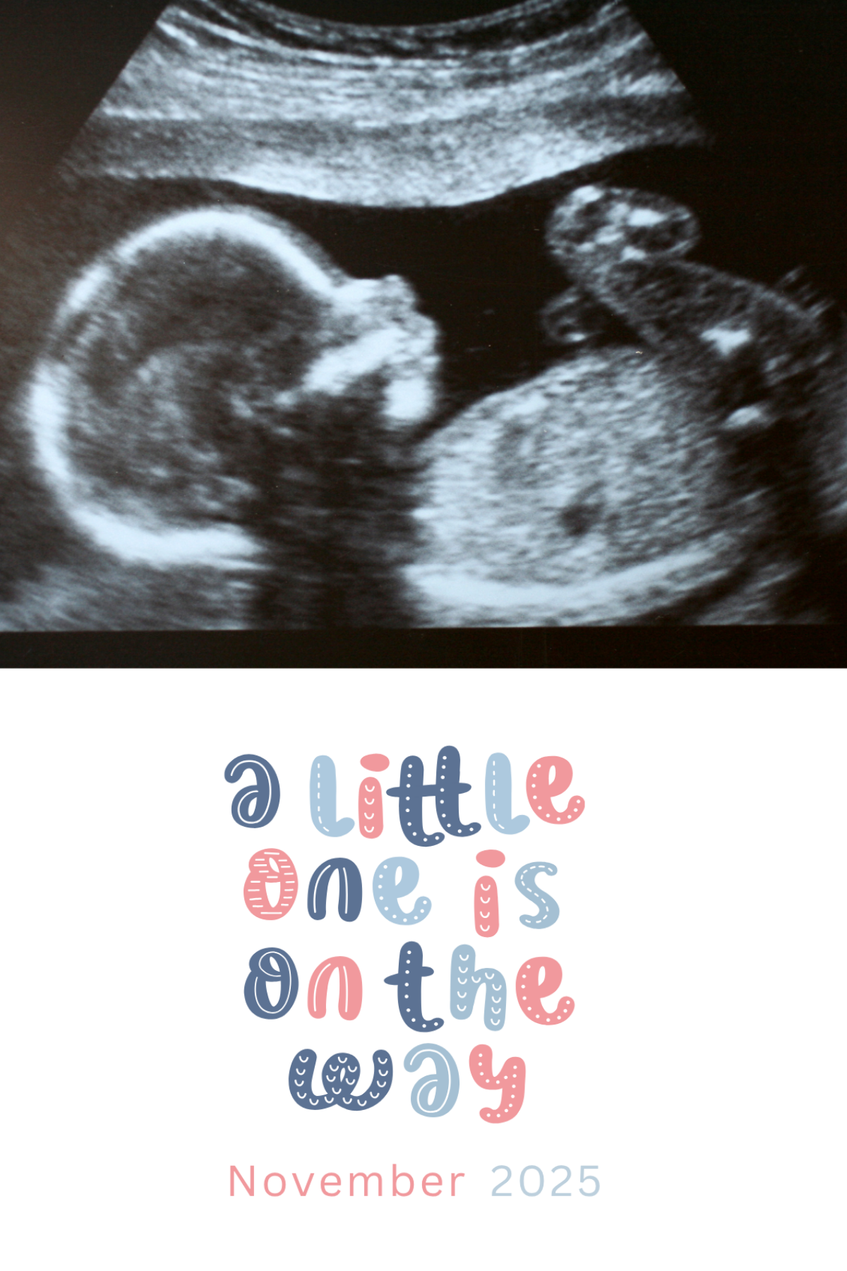 Set of 12 Custom Magnetic Baby & Pregnancy Announcements – Share Your Big News in Style!